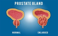 Prostate Gland